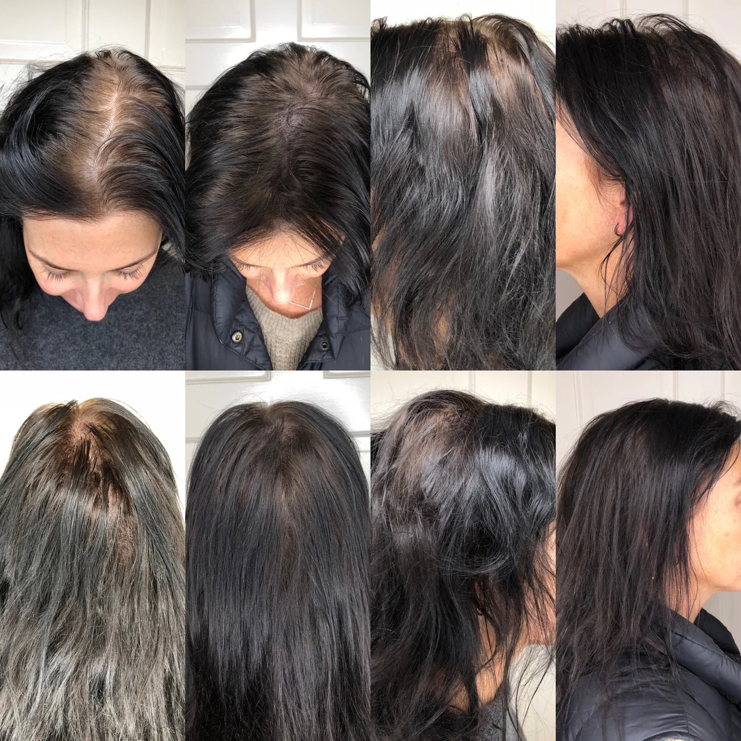 Collage of a person with different hairstyles and hair conditions.